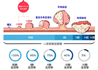 直肠癌早筛试剂盒“第一证”—足不出户而明察秋毫